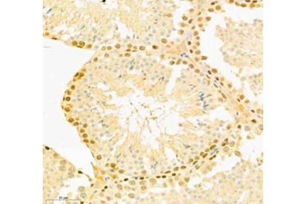 COMMD4 antibody