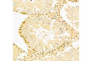 Immunohistochemistry of paraffin embedded mouse testis using COMMD4 (ABIN7073559) at dilution of 1: 800 (300x lens) (COMMD4 antibody)