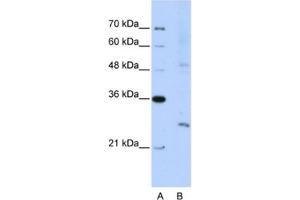 Western Blotting (WB) image for anti-Exosome Component 4 (EXOSC4) antibody (ABIN2462286)