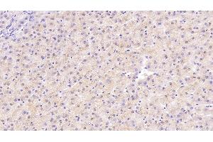 Detection of NT3 in Human Liver Tissue using Monoclonal Antibody to Neurotrophin 3 (NT3) (Neurotrophin 3 antibody  (AA 130-255))