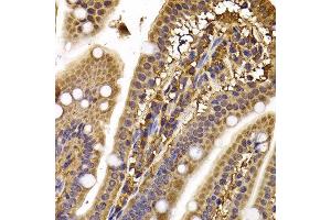 Immunohistochemistry of paraffin-embedded mouse ileum using CLASP1 antibody at dilution of 1:100 (x400 lens). (CLASP1 antibody)