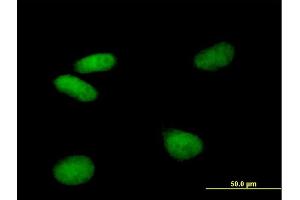 Immunofluorescence of purified MaxPab antibody to VPS72 on HeLa cell.