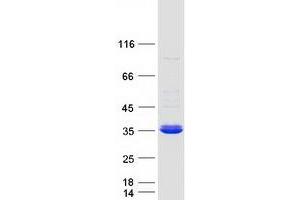 Validation with Western Blot