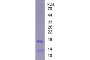 SDS-PAGE of Protein Standard from the Kit (Highly purified E. (LIPC ELISA Kit)