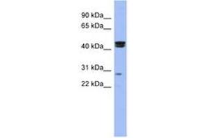 Image no. 1 for anti-Heat Shock Transcription Factor, Y-Linked 1 (HSFY1) (N-Term) antibody (ABIN6742900) (HSFY1 antibody  (N-Term))