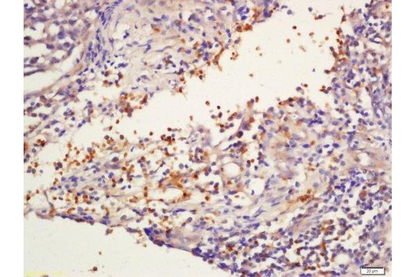 GNLY antibody  (AA 23-120)