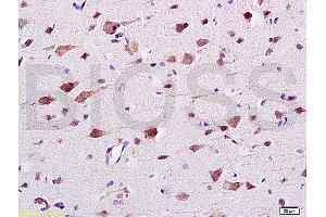 Formalin-fixed and paraffin embedded: rat brain tissue labeled with Anti-CaMK2b Polyclonal Antibody (ABIN669876), Unconjugated at 1:200 followed by conjugation to the secondary antibody and DAB staining (CAMK2B antibody  (AA 1-100))