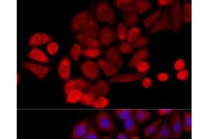 Immunofluorescence analysis of HeLa cells using PIDD Polyclonal Antibody at dilution of 1:100 (40x lens). (PIDD antibody)