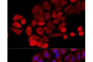 Immunofluorescence analysis of HeLa cells using PIDD Polyclonal Antibody at dilution of 1:100 (40x lens). (PIDD antibody)