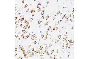 Immunohistochemistry (IHC) image for anti-Eukaryotic Translation Elongation Factor 1 gamma (EEF1G) (AA 168-437) antibody (ABIN6139951)