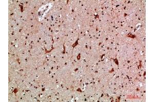 Immunohistochemical analysis of paraffin-embedded human-brain, antibody was diluted at 1:200 (MBL2 antibody  (AA 21-70))