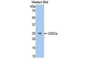 Western Blotting (WB) image for anti-Cytochrome P450, Family 2, Subfamily E, Polypeptide 1 (CYP2E1) (AA 126-309) antibody (ABIN1174041) (CYP2E1 antibody  (AA 126-309))