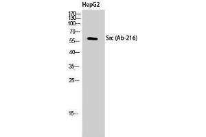 Western Blotting (WB) image for anti-Proto-oncogene tyrosine-protein kinase Src (Src) (Tyr1161) antibody (ABIN3174585) (Src antibody  (Tyr1161))