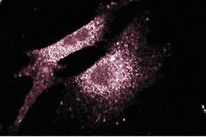 Immunofluorescence staining of NIH/3T3 cells (Mouse embryo fibroblast cells, ATCC CRL-1658). (SLC9A1 antibody  (AA 682-801))