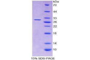 SDS-PAGE (SDS) image for Adenylate Cyclase 1 (Brain) (ADCY1) (AA 835-1061) protein (His tag) (ABIN2123923)