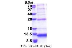 SDS-PAGE (SDS) image for Chromosome 5 Open Reading Frame 13 (C5orf13) (AA 1-68) protein (His tag) (ABIN5853392) (NREP Protein (AA 1-68) (His tag))