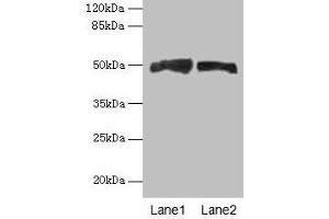 Western blot All lanes: AZIN1 antibody at 4 μg/mL Lane 1: Mouse liver tissue Lane 2: PC-3 whole cell lysate Secondary Goat polyclonal to rabbit IgG at 1/10000 dilution Predicted band size: 50 kDa Observed band size: 50 kDa (Antizyme Inhibitor 1 antibody  (AA 101-400))