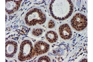 Immunohistochemical staining of paraffin-embedded Human breast tissue using anti-TIMP2 mouse monoclonal antibody. (TIMP2 antibody)