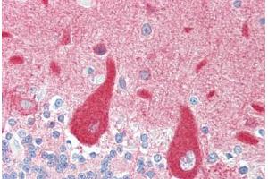 Human Brain, Cerebellum (formalin-fixed, paraffin-embedded) stained with CRMP1 antibody ABIN461920 at 5 ug/ml followed by biotinylated goat anti-rabbit IgG secondary antibody ABIN481713, alkaline phosphatase-streptavidin and chromogen. (CRMP1 antibody  (N-Term))