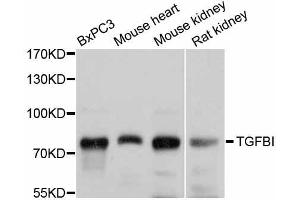 Western blot analysis of extracts of various cell lines, using TGFBI antibody (ABIN5999036) at 1/1000 dilution. (TGFBI antibody)