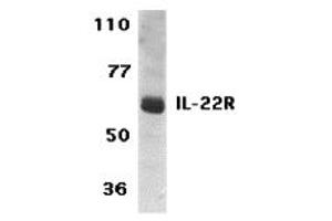 Western Blotting (WB) image for anti-Interleukin 22 Receptor (IL22R) (C-Term) antibody (ABIN1030435) (IL22R antibody  (C-Term))