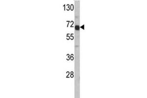 Western blot analysis of AFP antibody and HepG2 lysate. (alpha Fetoprotein antibody  (AA 56-85))