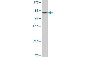 Western Blot detection against Immunogen (80. (ALT antibody  (AA 1-496))
