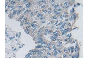 Immunohistochemistry (IHC) image for anti-Desmoplakin (DSP) (AA 2609-2822) antibody (ABIN7434746)