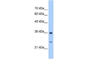 GSTZ1 antibody used at 2. (GSTZ1 antibody)
