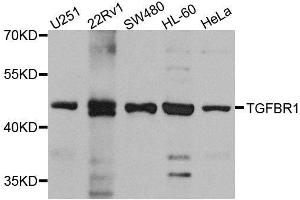 Western blot analysis of extracts of various cell lines, using TGFBR1 antibody. (TGFBR1 antibody  (AA 34-124))