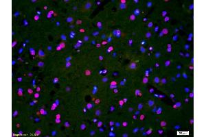 Formalin-fixed and paraffin-embedded rat brain labeled with Anti-Phospho-HER3(Tyr1328) Polyclonal Antibody, Unconjugated (ABIN800628) 1:200, overnight at 4°C, The secondary antibody was Goat Anti-Rabbit IgG, Cy3 conjugated used at 1:200 dilution for 40 minutes at 37°C. (ERBB3 antibody  (pTyr1328))