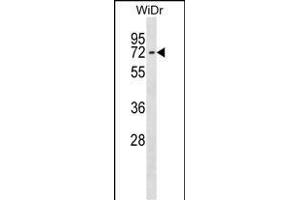CTNNBL1 Antibody (N-term) (ABIN1539081 and ABIN2848704) western blot analysis in WiDr cell line lysates (35 μg/lane). (CTNNBL1 antibody  (N-Term))
