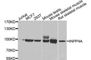 Western blot analysis of extracts of various cell lines, using INPP4A antibody (ABIN5975622) at 1/1000 dilution. (INPP4A antibody)