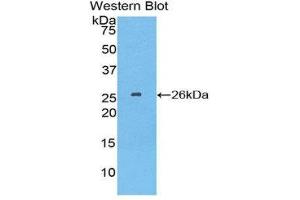 Western Blotting (WB) image for anti-Tubulin Polymerization Promoting Protein (Tppp) (AA 8-210) antibody (ABIN1860848)