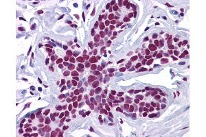 Anti-ZSCAN4 antibody IHC of human breast. (ZSCAN4 antibody  (C-Term))