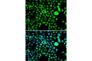 Immunofluorescence analysis of MCF-7 cells using SMCHD1 antibody (ABIN5974343). (SMCHD1 antibody)