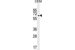 UNCX Antibody (C-term) western blot analysis in CEM cell line lysates (35 µg/lane). (UNCX antibody  (C-Term))