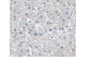 Immunohistochemistry (IHC) image for anti-Apolipoprotein A-I (APOA1) (AA 122-267) antibody (ABIN7427912)