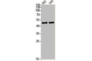 Western Blotting (WB) image for anti-Mitogen-Activated Protein Kinase Kinase 2 (MAP2K2) (pThr394) antibody (ABIN7181961)