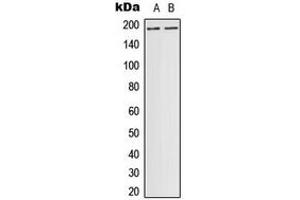 Western blot analysis of DCC expression in ACHN (A) whole cell lysates.
