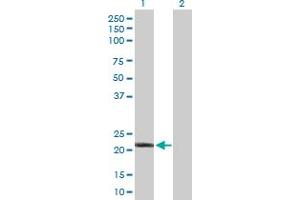 Western Blot analysis of IFNA10 expression in transfected 293T cell line by IFNA10 MaxPab polyclonal antibody. (IFNA10 antibody  (AA 1-189))