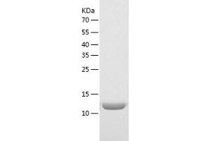 Western Blotting (WB) image for Mediator Complex Subunit 21 (MED21) (AA 1-144) protein (His tag) (ABIN7287108) (MED21 Protein (AA 1-144) (His tag))