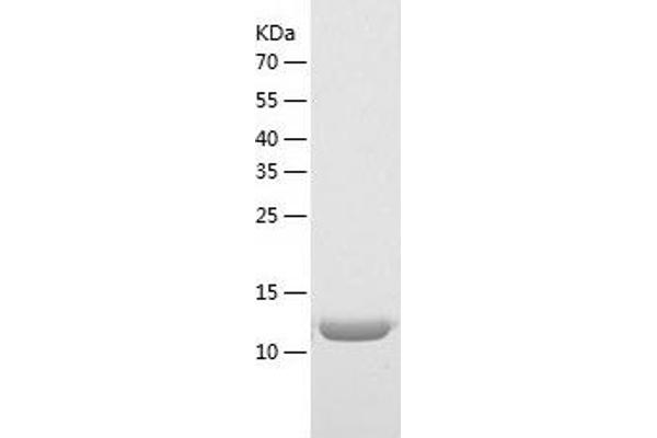 MED21 Protein (AA 1-144) (His tag)