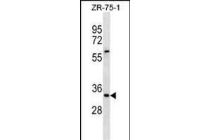 ING2 Antibody (Center) (ABIN1881460 and ABIN2838392) western blot analysis in ZR-75-1 cell line lysates (35 μg/lane). (ING2 antibody  (AA 112-141))