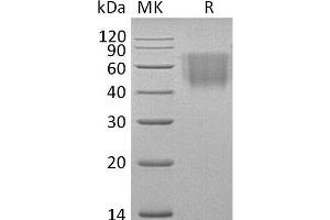 Western Blotting (WB) image for CD86 (CD86) protein (His tag) (ABIN7320996) (CD86 Protein (CD86) (His tag))