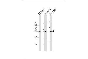 Lane 1: mouse liver lysates, Lane 2: mouse testis lysates, Lane 3: human testis lysates, probed with CDX1 (937CT11.