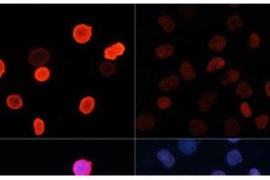 Immunofluorescence (IF) image for anti-Histone H2B (acLys5) antibody (ABIN7258524)