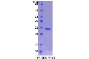 Image no. 1 for CD164 (CD164) (AA 24-160) protein (T7 tag,His tag) (ABIN4988761)