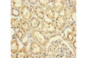Immunohistochemistry of paraffin-embedded human kidney tissue using ABIN7174174 at dilution of 1:100 (PRPF4 antibody  (AA 1-260))