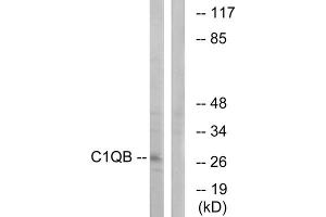 Western blot analysis of extracts from Jurkat cells, using C1QB antibody. (C1QB antibody  (C-Term))